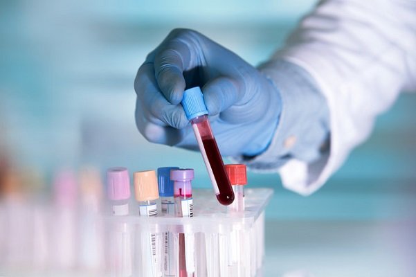 طراحی تست خون برای تشخیص زودهنگام سرطان/ درمان بر اساس ژنتیک فرد